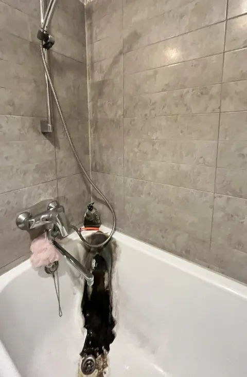 I burned my bath