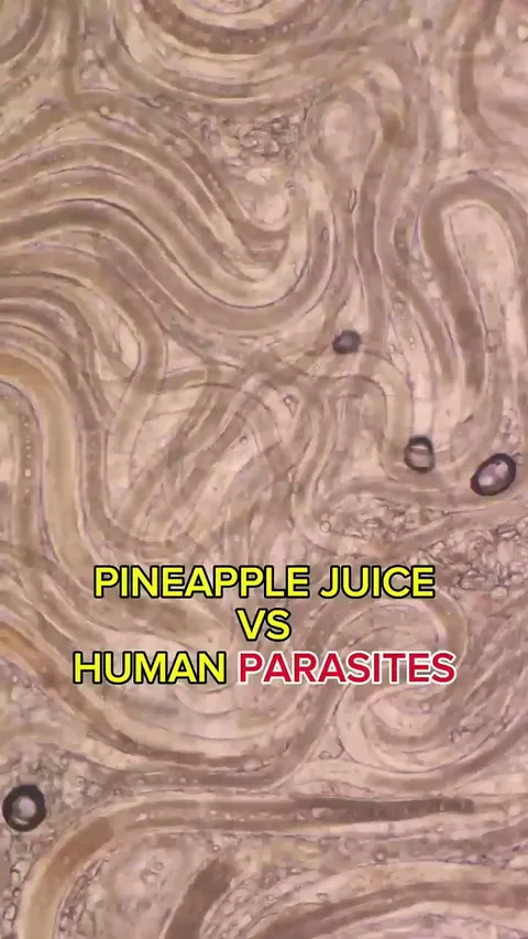Pineapple Juice vs Parasites