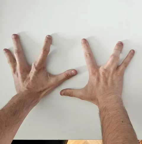 I was born with four fingers (missing the middle finger)