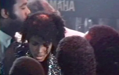 Michael Jackson after his hair had caught on fire. Jackson was exactly 25 years, 4 months and 29 days old when this happened, fast forward another 25 years, 4 months and 29 days later, he would die in 2009. Meaning that this incident took place at the exact halfway point of his life.
