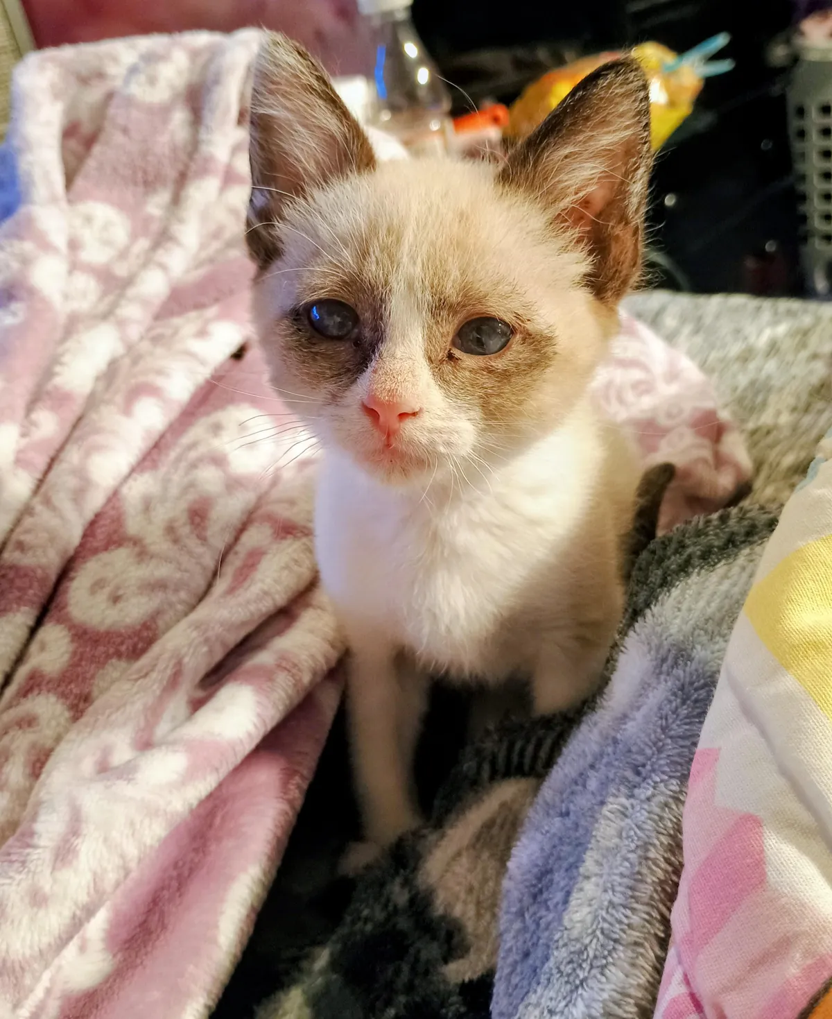 This guy somehow resolved a massive eye mass by himself and avoided life threatening surgery