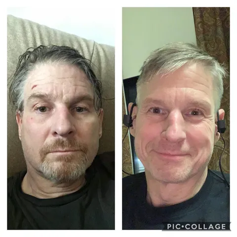 A year ago I was depressed and suicidal. Today things have gotten better. #vahealthcare