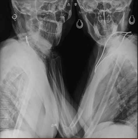 ITAP of my best friend and I on an x-ray machine