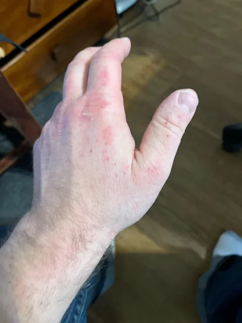 I hate having dry skin