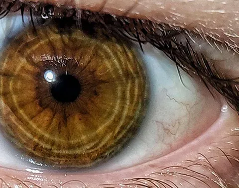 My eyes have cool rings 