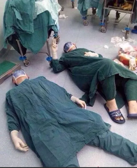 Exhausted surgeons collapse after a 32-hour brain surgery to save a life. The photo went viral.