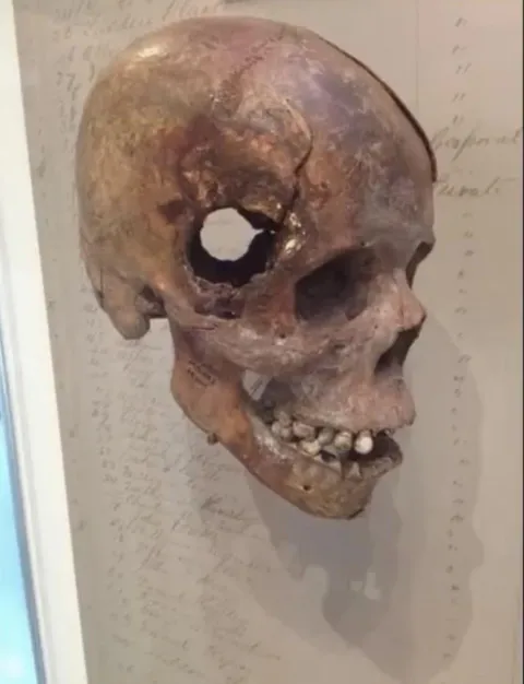 Would it be at all possible to survive this?