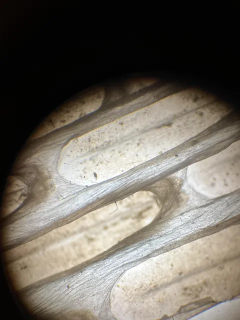 I found a snake shed and put it under my microscope