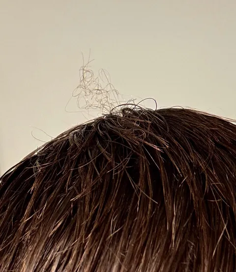 My straight hair has.  patch of curly hair in the middle