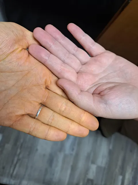 How orange my hands are... I'm normally paler than my partner