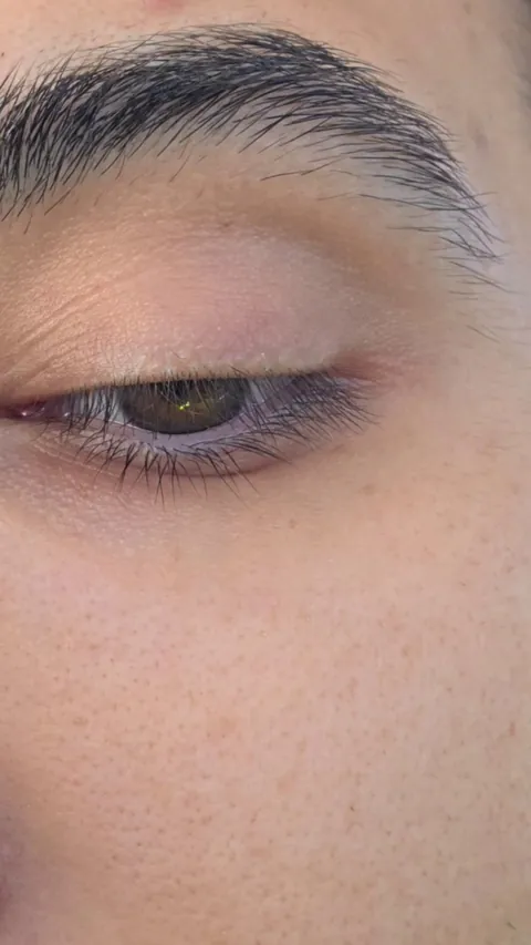 My bottom eyelid won't stop twitching!!