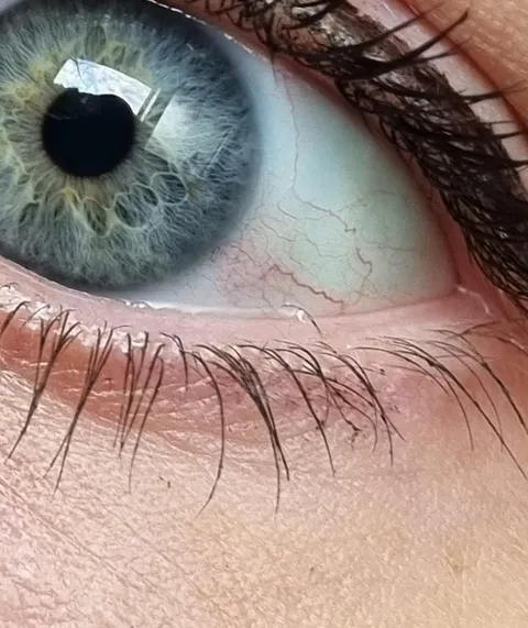 Thought I had something in my eye all day, turns out it's an eyelash growing into my eyeball. No way of getting it out for 2 more hours.
