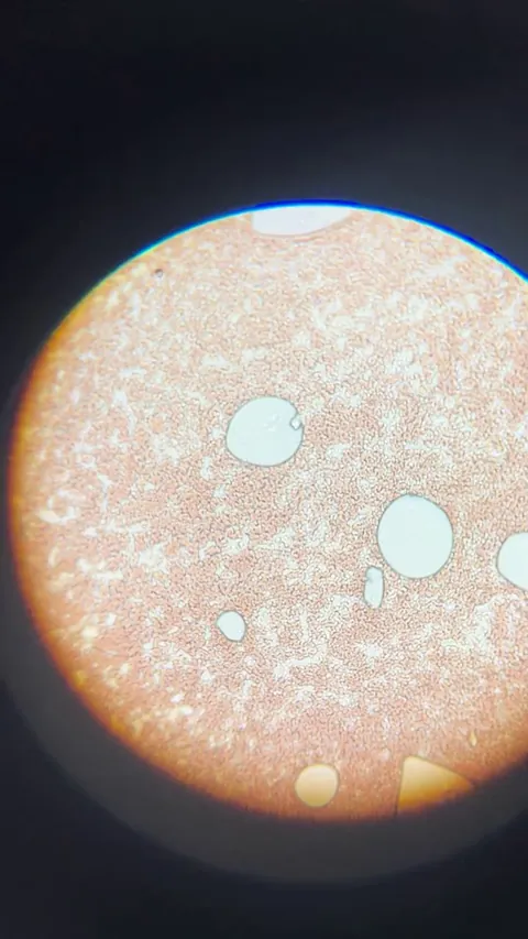 Blood likes to flow even under a microscope 🩸