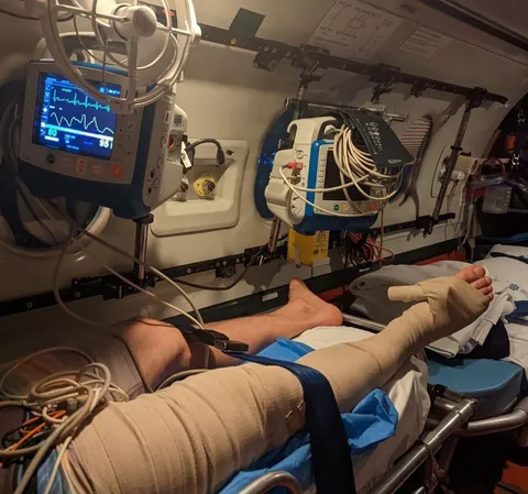 In Australia, this costs the patient nothing. Even a non-citizen - no charge.