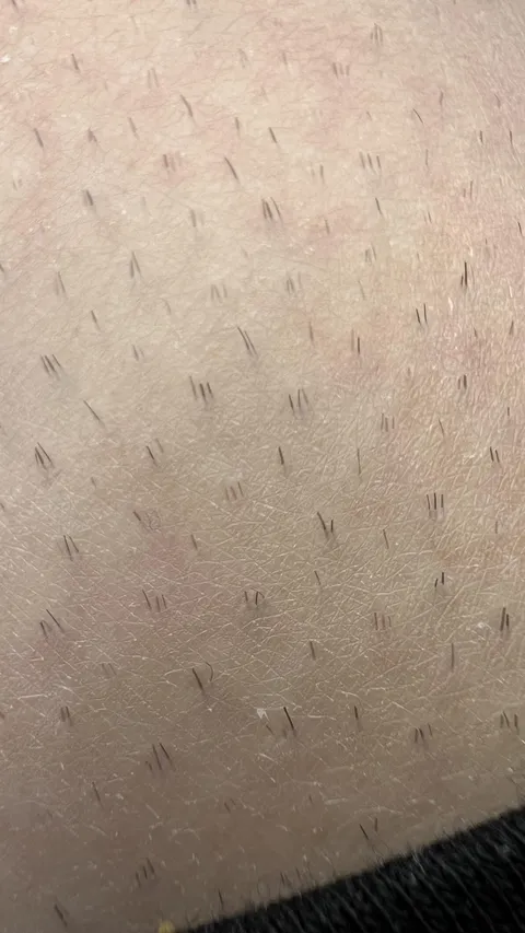 All my hairs are triplets!