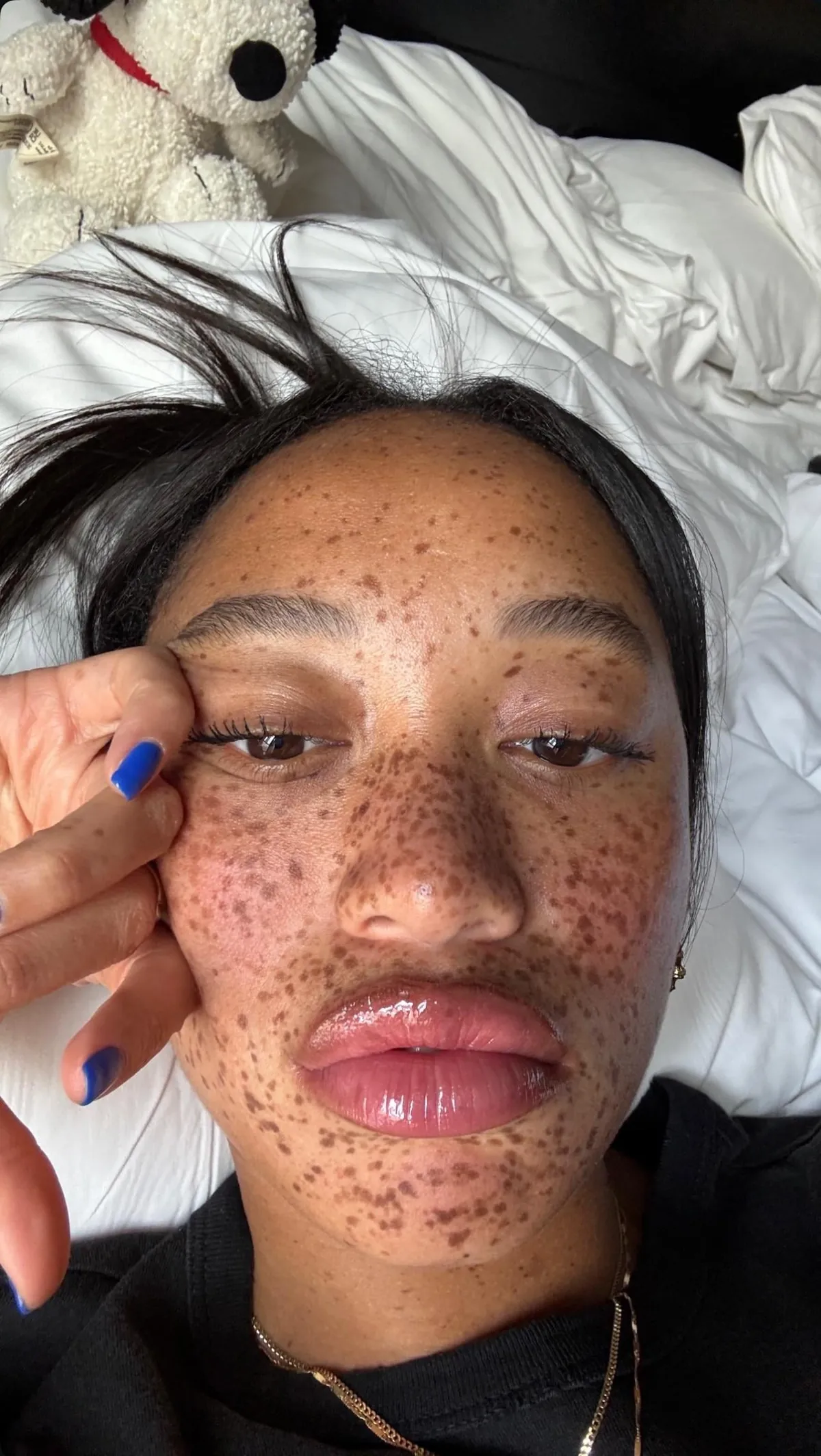 freckles😮‍💨🫶🏾