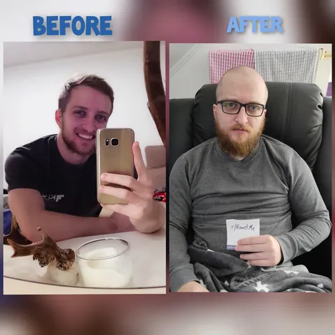 Just 2,5 years between both pictures .. what happend to me .. roast me!