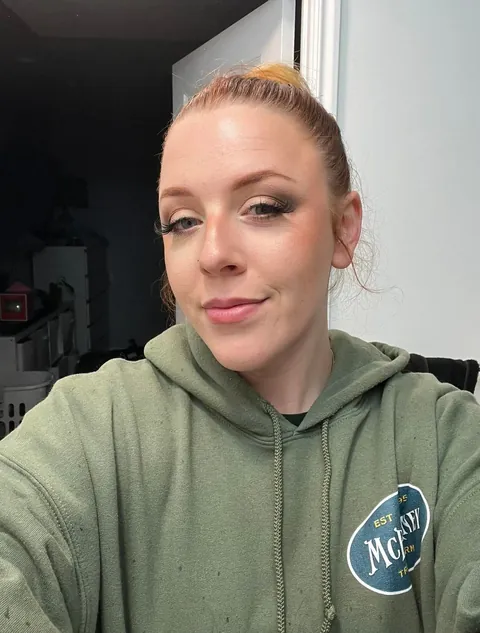 Massive Black Eye Cover Up Before &amp; After