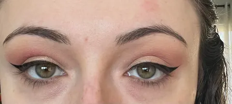 Color correcting doesn’t help my dark circles. Why?