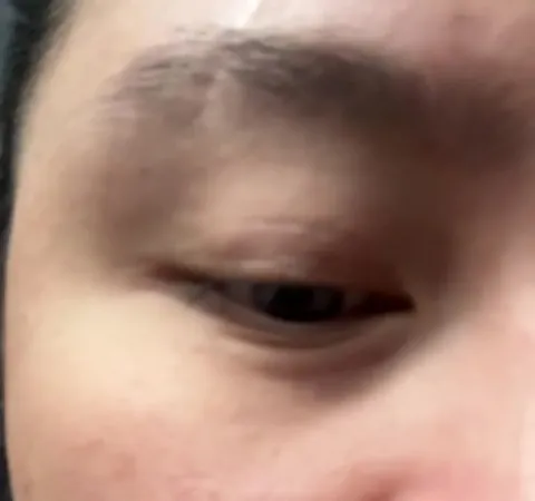 Eye twitch has become a source of insecurity for me