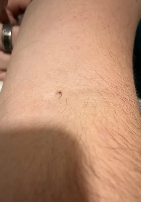 My husband has donated plasma so many times he has a permanent hole in his arm.