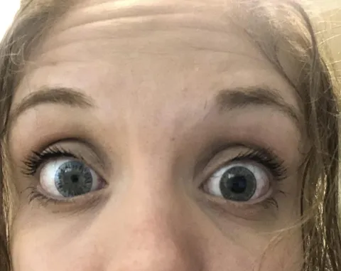 My pupils aren’t the same size sometimes and idk why