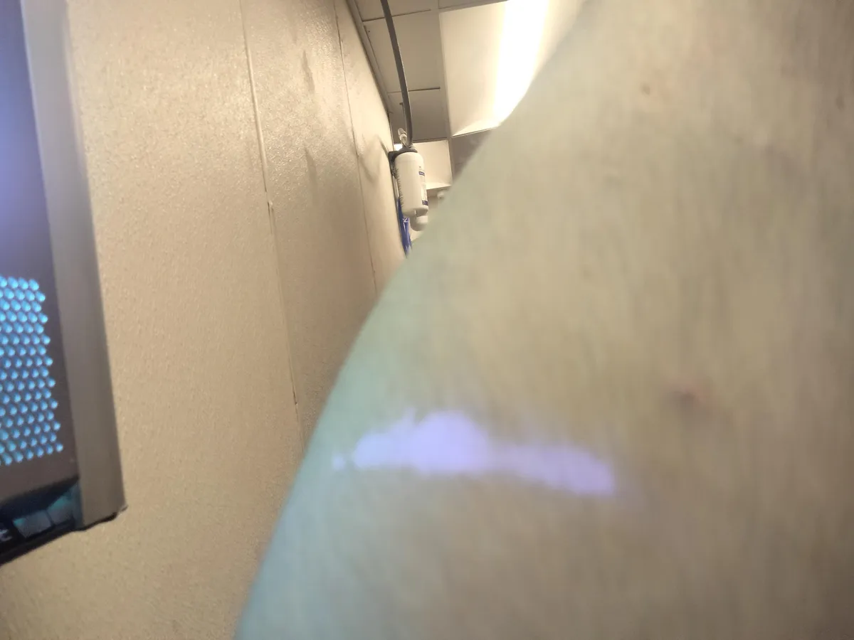 A bit of my arm glows under UV light for some reason 