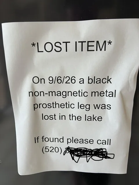 Lost Leg