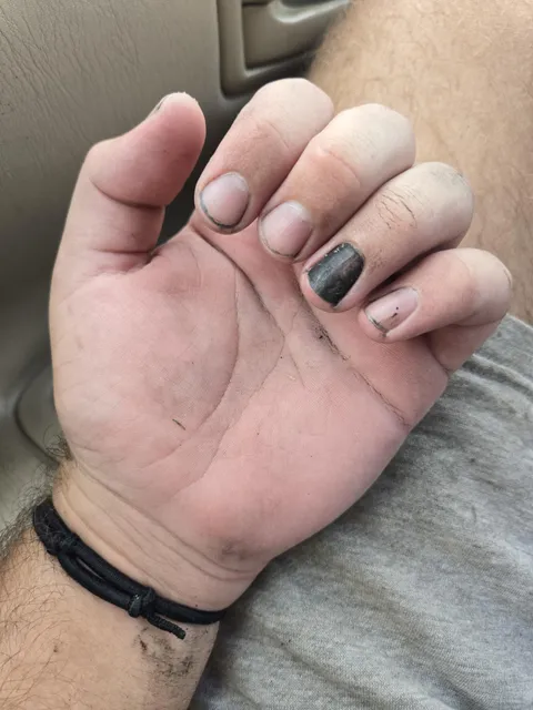 I was sealing an asphalt driveway and I somehow perfectly stained one nail black