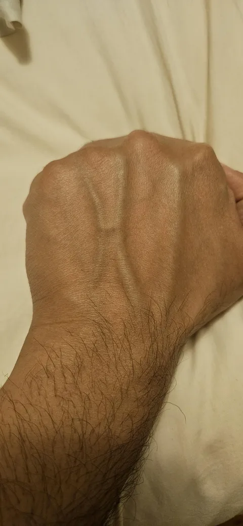 The veins in my left hand are always saying "HI" to me