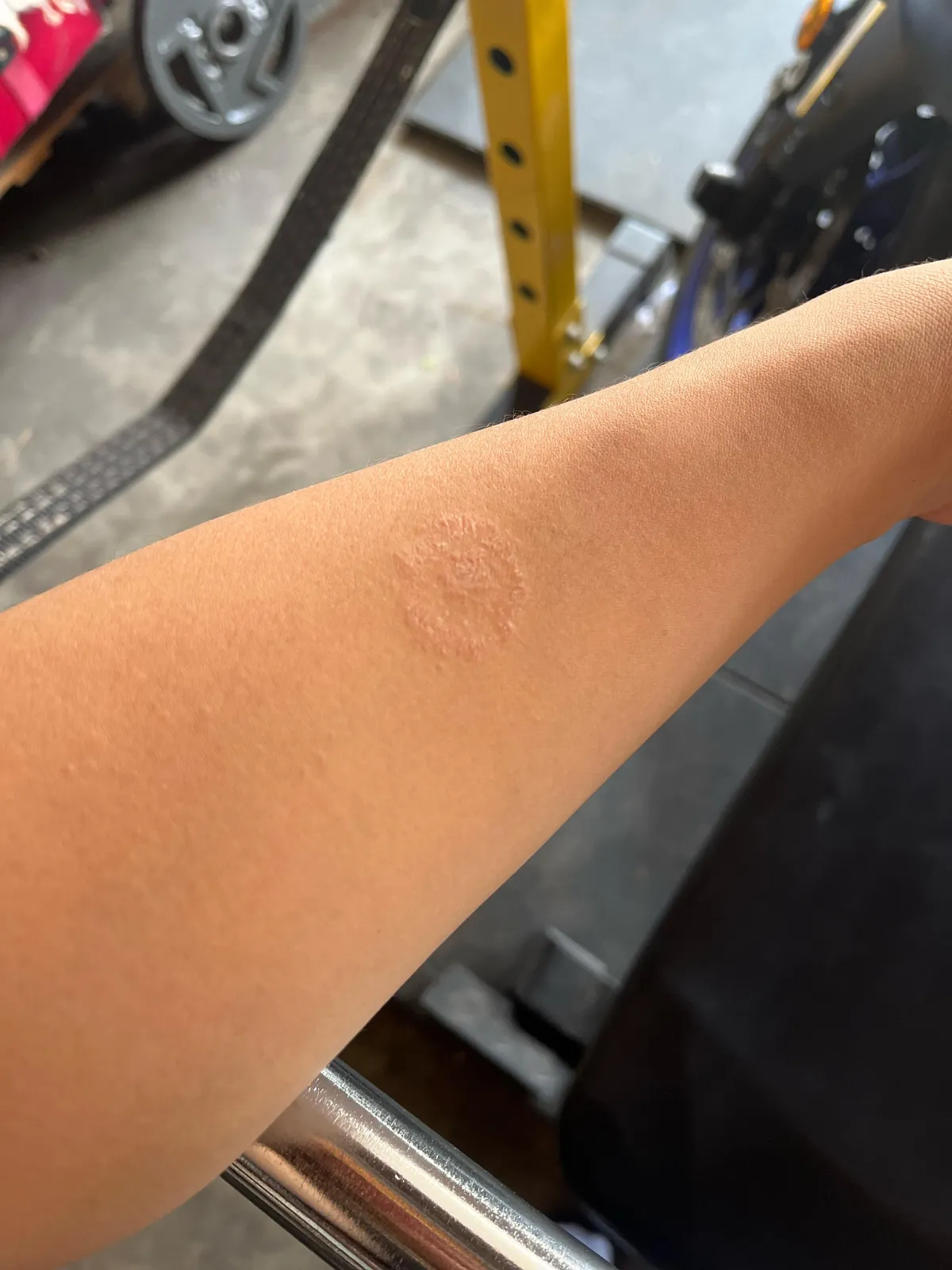 Weird patch on my arm that doesn’t come off ever