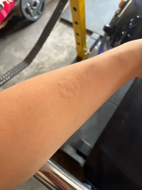 Weird patch on my arm that doesn’t come off ever