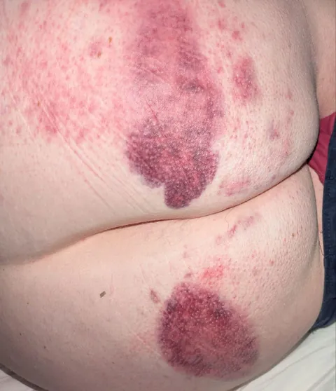 The night of and the morning after and the night after....