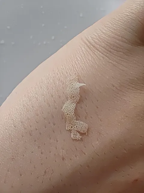 Some skin peeled off my tongue 