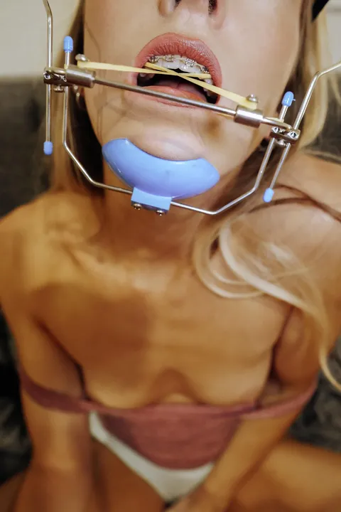 Naughty little braces freak 🙋🏼‍♀️