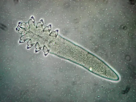 These organisms(Demodex Mites) live on every human face.