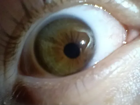 My pupils aren't in the middle of my eyes. Been like this since birth.