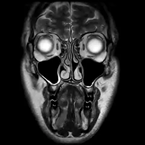 So I had an MRI last week and, kinda scary.