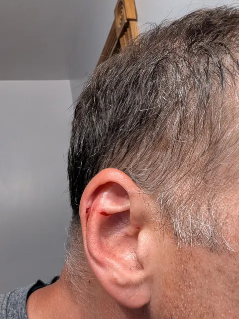 Almost assassinated while mowing my lawn