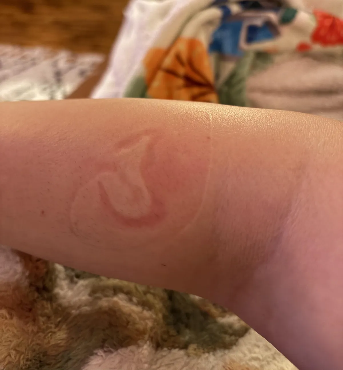 My boyfriend fell asleep on me and left an ear print