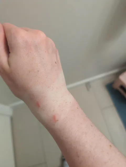 Hydrogen Peroxide temporarily bleached my wrist when I used it to clean some cat scratches 