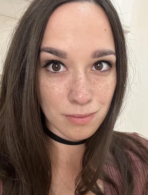 Freckles on freckles. I have to many to count. 