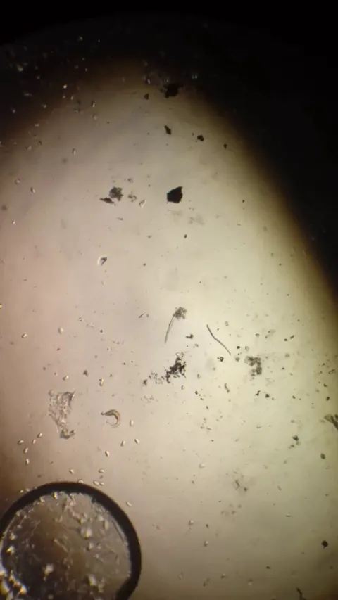 Probably my best footage yet. Dileptus killing and eating a fairly large ciliate