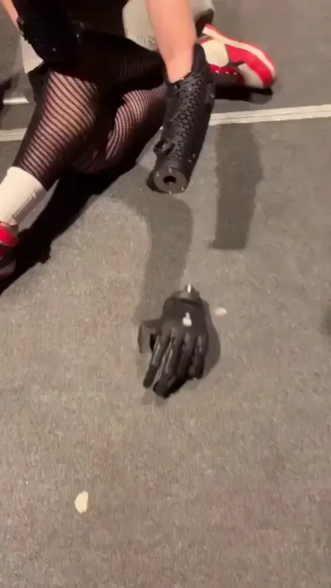 Prosthetic hand that move with nerve signals