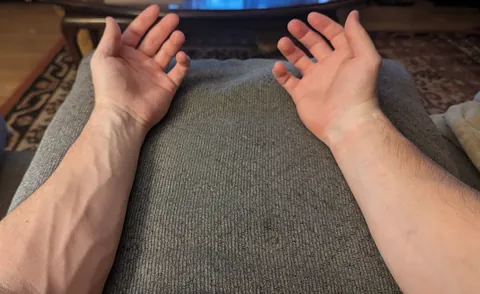 Differences in vascularity between my left arm and my right arm.