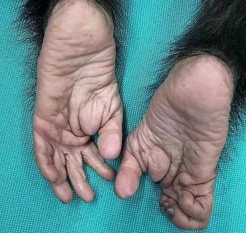 🔥 Close up of the feet of a chimpanzee