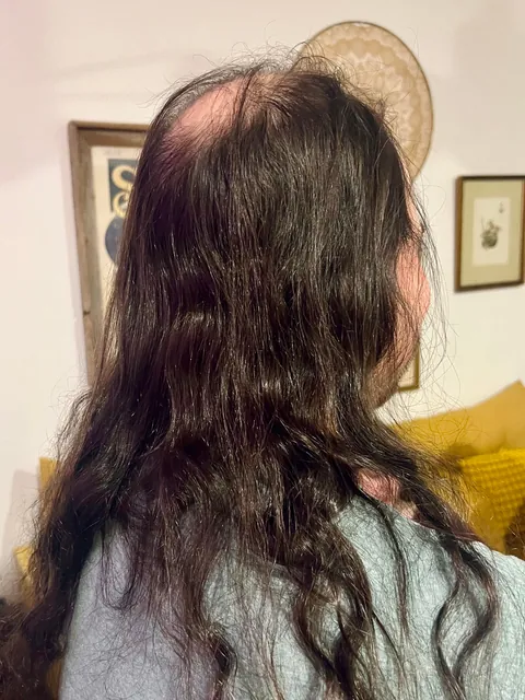 One of my dearest friends finally took the plunge thanks to this subreddit!