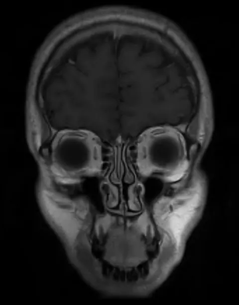 So I had an MRI last week and, kinda scary.