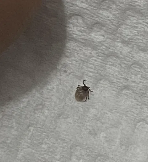 I scratched something off my back thinking its a pimple. it wasnt a pimple :(