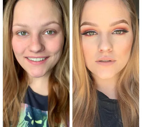 Before and After MOTD